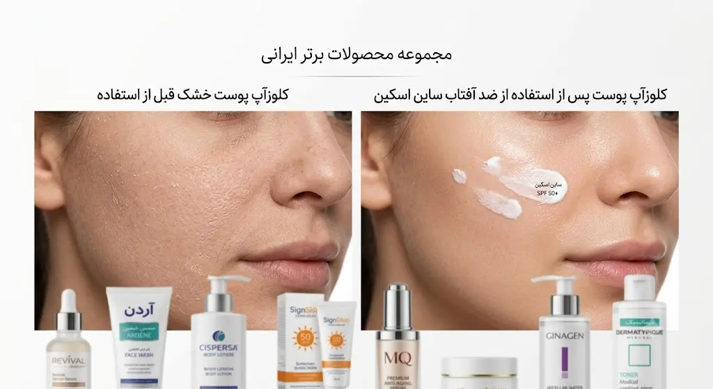 بهترین کرم روشن کننده ایرانی برای پوست خشک